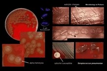 streptococcus pneumoniae